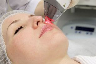 The process of rejuvenating facial skin with a fractional laser