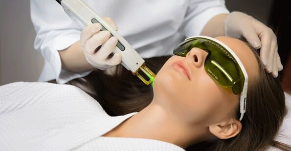 Non-ablative laser procedure for skin rejuvenation